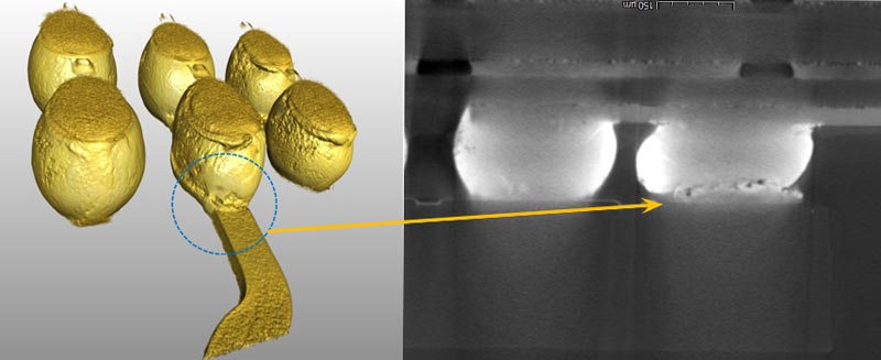 Step-2-Imaging-3D-X-ray